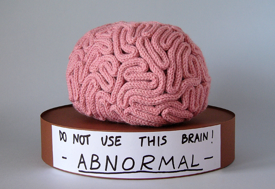 Abnormal brain